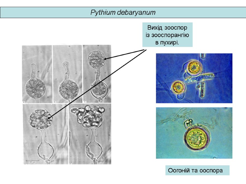 Вихід зооспор із зооспорангію в пухирі. Оогоній та ооспора Pythium debaryanum
